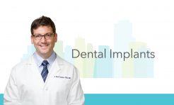 Dental Implants placed by Dr. J. Reed Rayher, DDS, MD in San Francisco CA